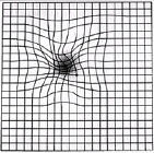 amsler grid Амслера решётка_при макулодистрофии